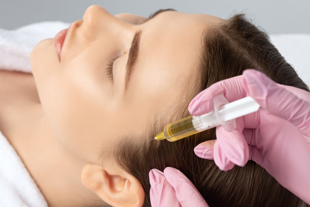 Close-up of a person undergoing Platelet-Rich Plasma (PRP) therapy for hair growth.