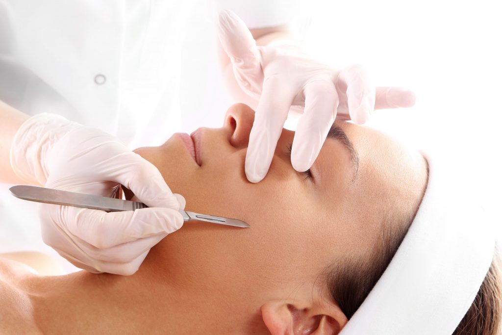 A close-up view of a dermaplaning procedure being performed on a person's face, with a small blade gently removing dead skin and peach fuzz.