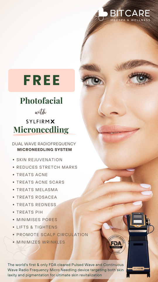 Microneedling-special-offers