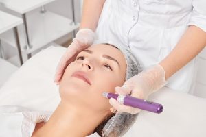 Benefits-of-micro-needling-on-all-skin-types