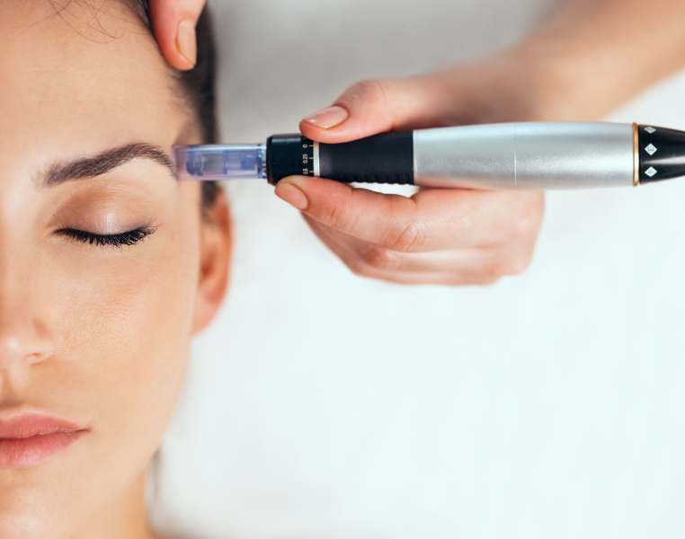 What is Microneedling?