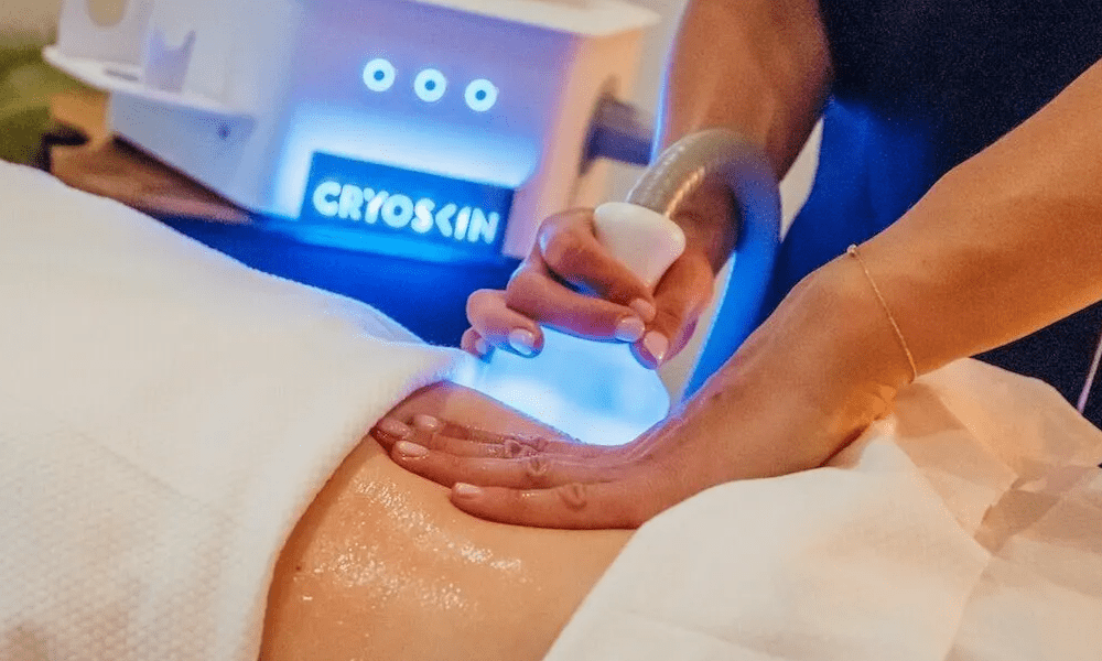 What to Expect During a Cryoskin Body Sculpting Session