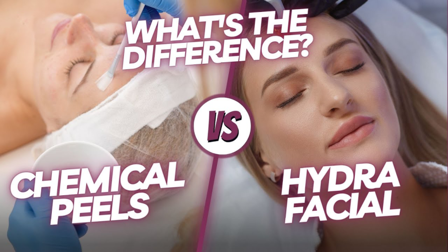 Hydrafacial vs. Chemical Peels: Which One is Best?